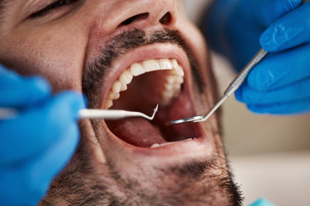 Best Emergency Treatment for Toothache in South Elgin, IL